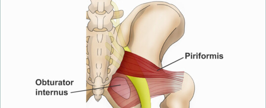 Piriformis Syndrome?